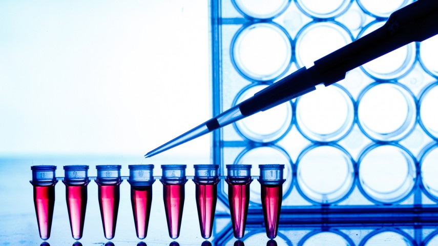 Uradite PCR test na COVID-19 infekciju!